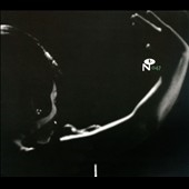 Image for 0825764104715-m